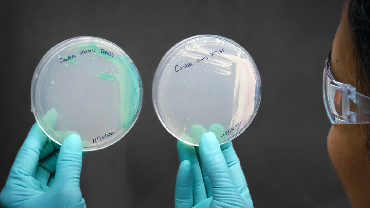 candida-auris-lab-1200 A lab scientist hold two closed petri dishes with strains of candida auris