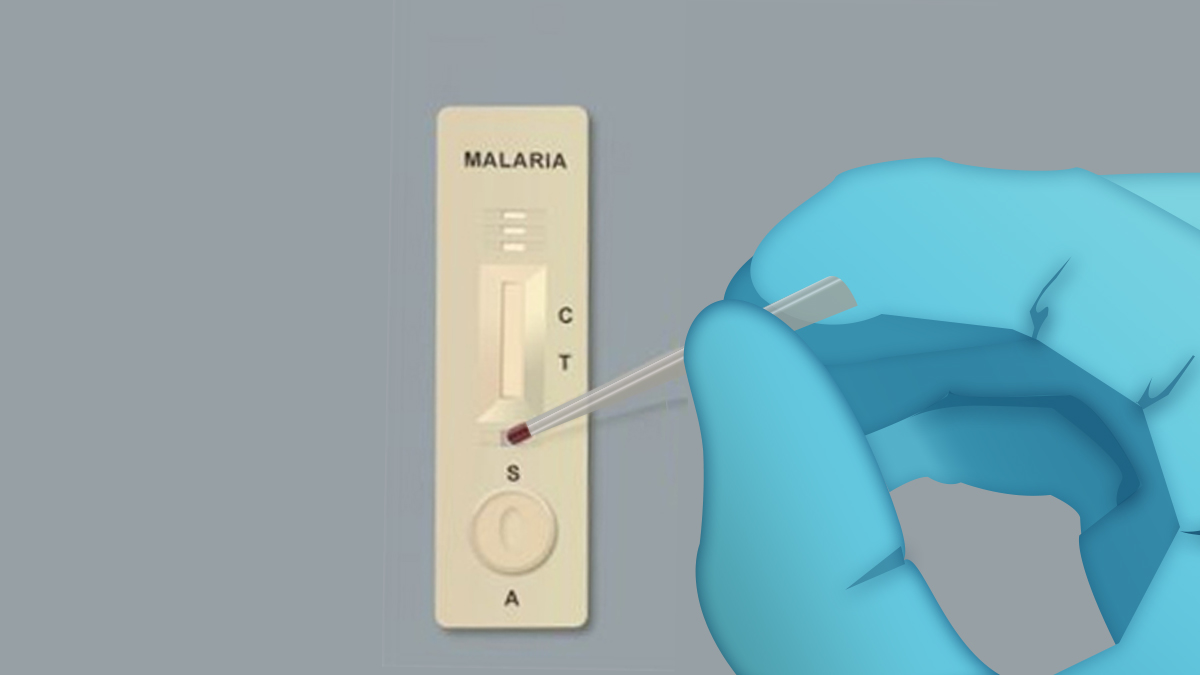 malaria-rdt-1200 illustration of a blue gloved hand dropping blood into the sample well of a test device