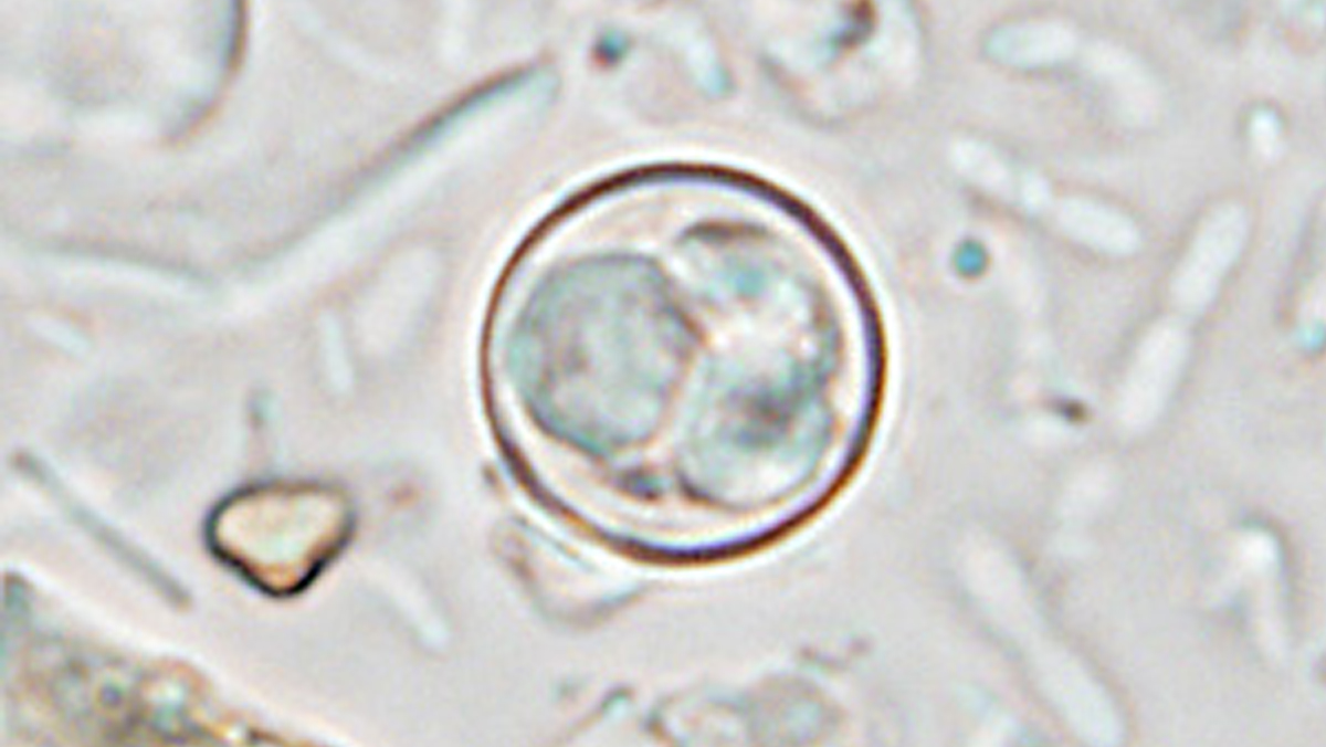 Oocsyt Cyclospora Magnified image of a parasite inside circular shell