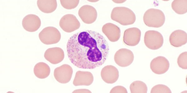 Anaplasmosis morula