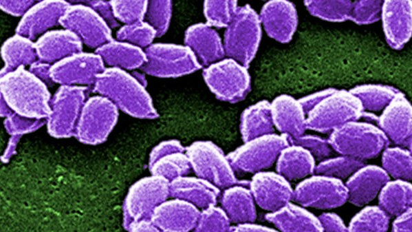Electron microscopic image of spores from the Sterne strain of Bacillus anthracis bacteria.