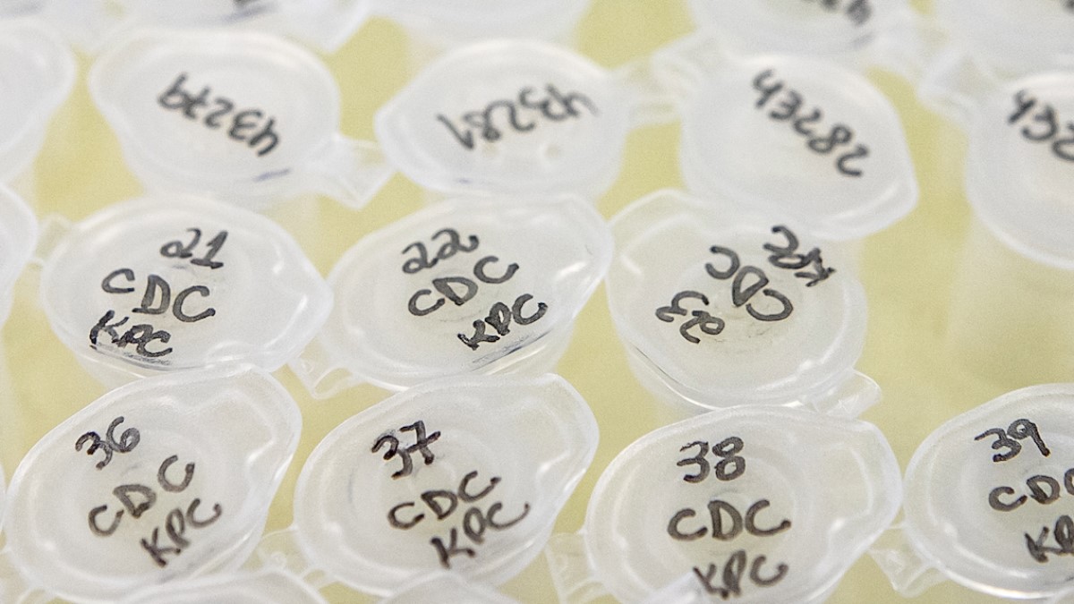 Brazil FIOTEC DNA prepped for qPCR DNA from multi-drug bacteria being prepared for qPCR.