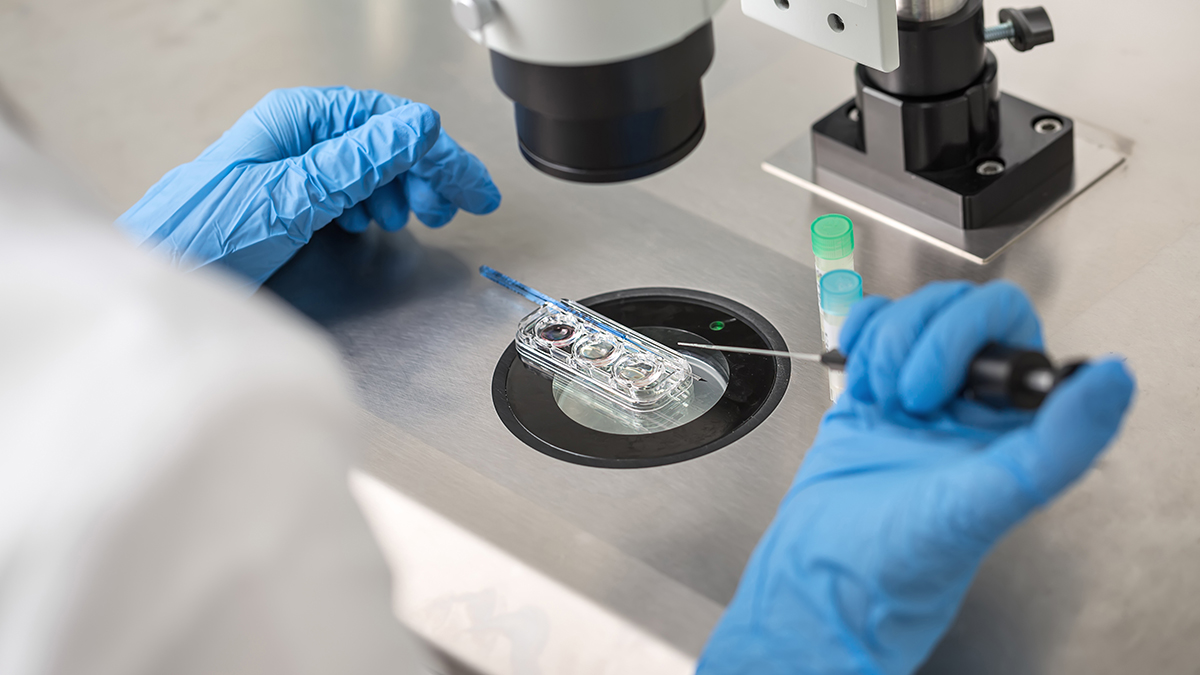 ART Surveillance thumb testing sample in lab