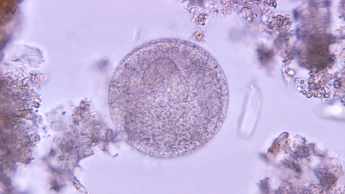 balantidium coli Balantidium coli parasitic cyst