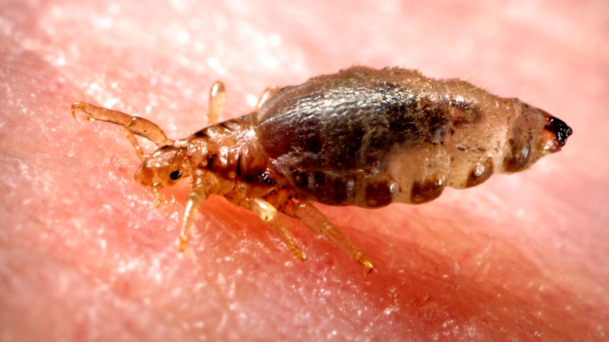 — title missing — Image of a human body louse