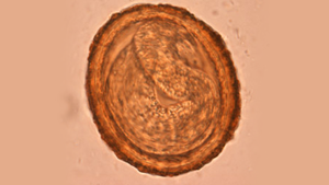 Baylisascaris egg Baylisascaris egg