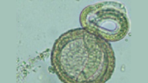 Bayliscaris Larva of B. procyonis hatching from egg