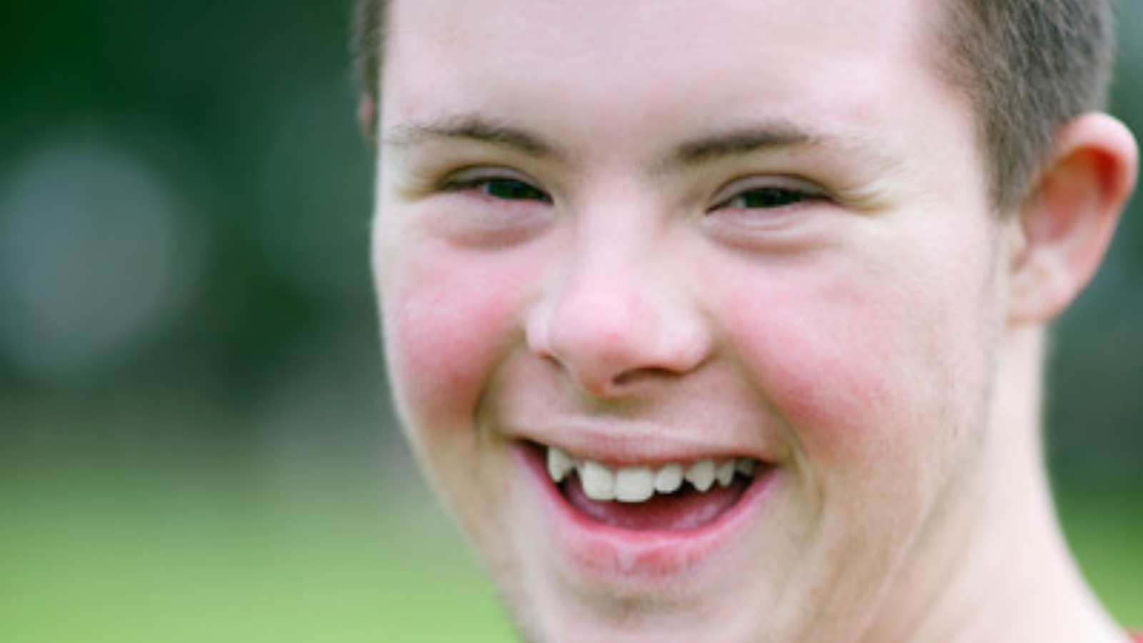 Untitleddesign5.png Up-close image of the smiling face of a teenager with Down syndrome.