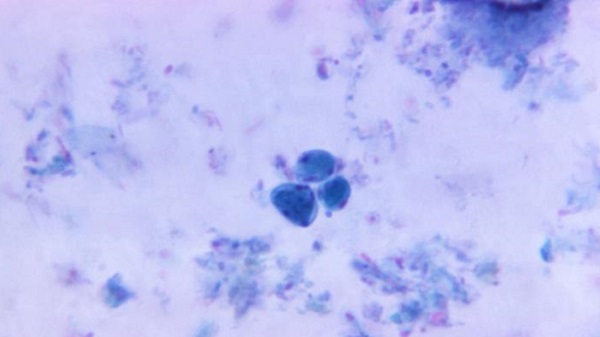 Blastocystis hominis Blastocystis hominis protozoan cysts