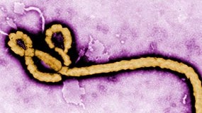 — title missing — Enlarged photo of the Ebola virus.