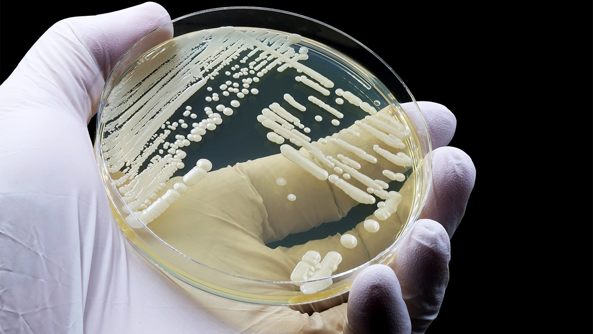Photo of a Petri dish with C. auris Photo of a Petri dish with C. auris