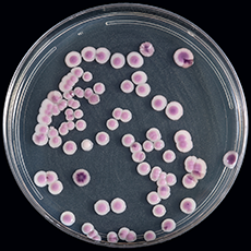 growninbroth4days230px.png Candida auris on CHROMagar Candida, here, for example, displays multiple color morphs.
