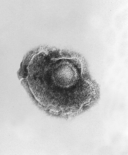 Electron micrograph of a varicella-zoster virus Electron micrograph of a varicella-zoster virus. Source: PHIL #1878.