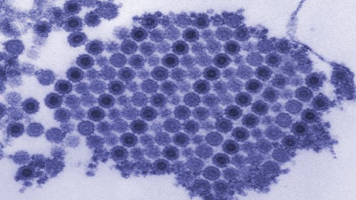 Electron microscopic image of chikungunya virus Electron microscopic image of chikungunya virus