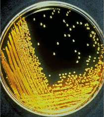 Vibrio cholerae growing on TCBS agar plate Vibrio cholerae colonies growing on thiosulfate-citrate-bile salts-sucrose (TCBS) agar plate.
