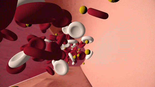 Cholesterol-Monster Is "bad" cholesterol building up in your arteries? Find out with a simple blood test. Talk to a health care professional about cholesterol screening.