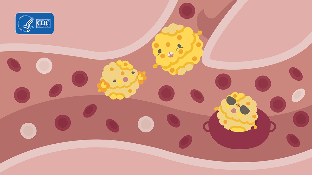 Cholesterol-Monster4 Illustration of three cholesterol monsters.