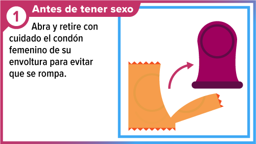 Female_condom_SPA-1 Un condón y su envoltorio abierto.