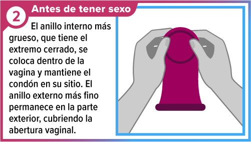 Female_condom_SPA-2 Un par de manos sosteniendo un condón femenino desde el anillo grueso, interno.