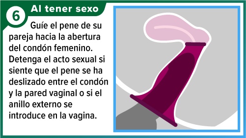 Female_condom_SPA-6 Condón femenino colocado, con el pene insertado dentro de la vagina.