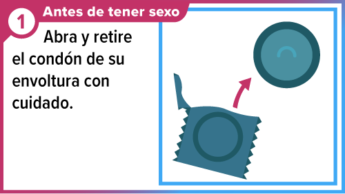 Male_condom_SPA-1 Condón fuera de su envoltorio.