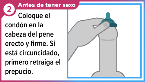 Male_condom_SPA-2 Mano poniendo un condón en la punta del pene.