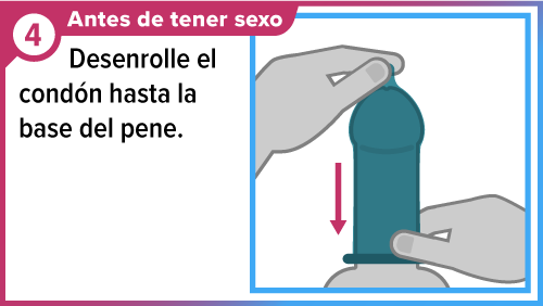 Male_condom_SPA-4 Mano desenrollando un condón a lo largo del pene.