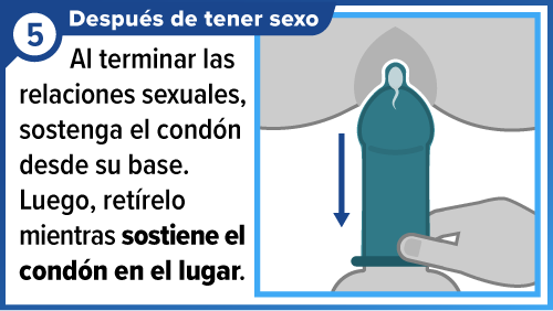 Male_condom_SPA Mano sosteniendo la base del condón al retirar el pene.
