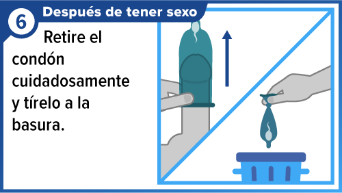 Male_condom_SPA-6 Mano quitando el condón del pene y botándolo a la basura.
