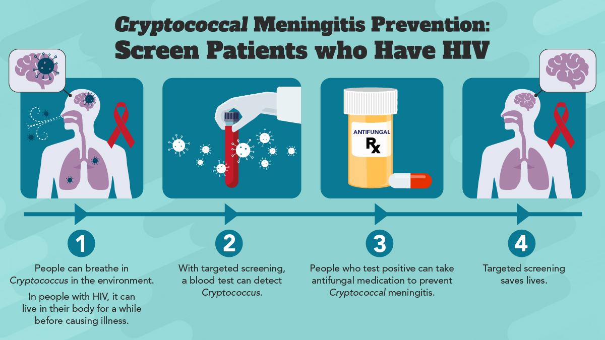 A 4 panel graphic illustration. A silhouette of a person with the red ribbon symbolizing HIV, breathes in Cryptococcus. A laboratory scientists hand holding a blood vial to demonstrate that the blood is tested for cryptococcal antigens. The third graphic panel shows prescription antifungals. In the last graphic the silloutte is seen again and the patient's brain is shown without cryptococcus spores.