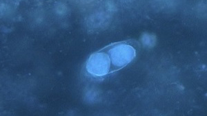 Cystoisospora Immature oocysts of Cystoisospora belli viewed by UV fluorescence microscopy.