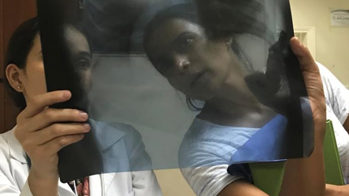 doctors examine an X-ray of a dengue patient