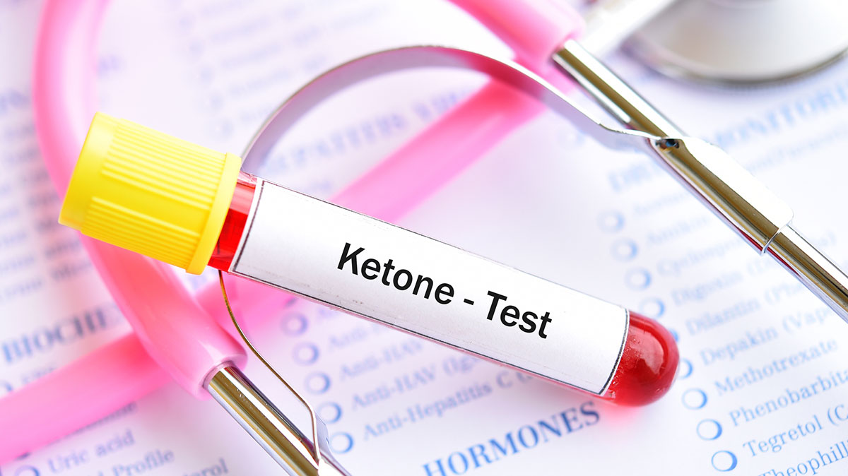 diabetic-ketoacidosis-dka vial saying ketones