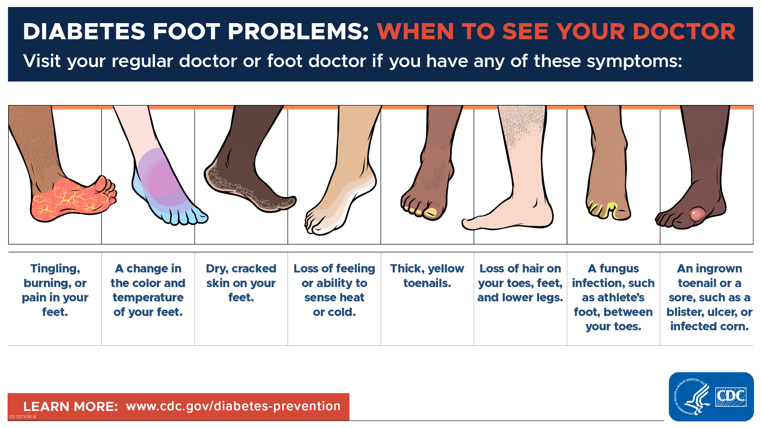 Diabetes Foot Problems - Visit your regular doctor or foot doctor if you have any of these symptoms.