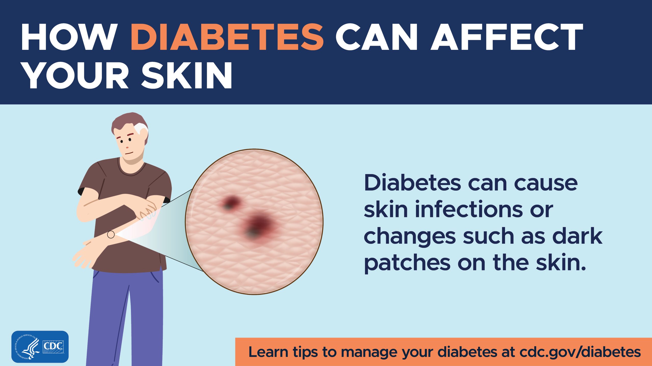 Diabetes can cause skin infections or changes such as dark patches on the skin.