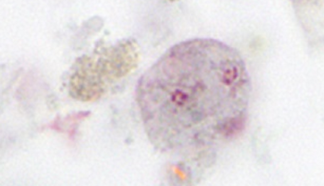 — title missing — Dientamoeba fragilis