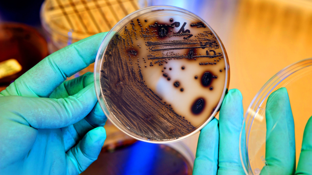Corynebacterium diphtheriae on Trisdal plate Diphtheria bacteria growing on a Tinsdale plate.