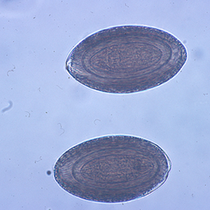 M_hirudinaceous_egg1.jpg