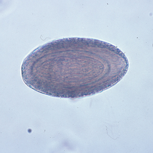 M_hirudinaceous_egg2.jpg