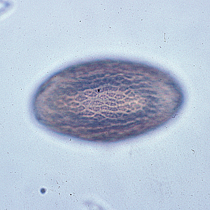 M_hirudinaceous_egg3.jpg
