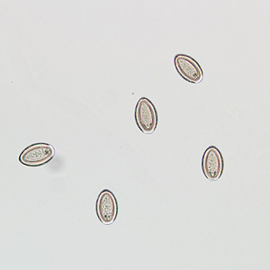 M_moniliformis_egg_HB1.jpg