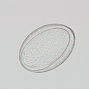 M_moniliformis_egg_HB2.jpg