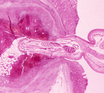 M_hirudinaceous_tissue1.jpg