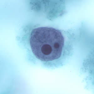 Ehisto_troph_tric6.jpg