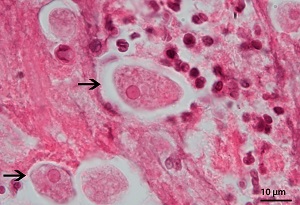 tissueB Figure B