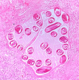 2C Figure C