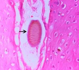 2F Figure E