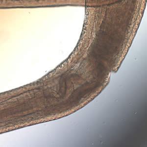 Pseudoterranova_mid_40x.jpg