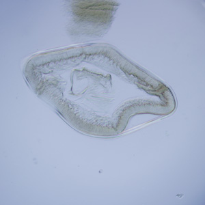 Anisakis_cross_section_HB1.jpg
