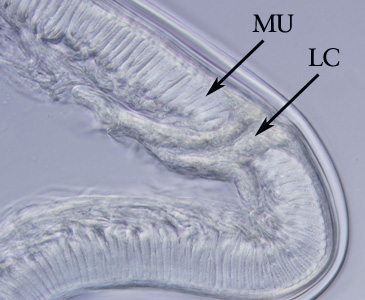 Anisakis_cross_section_HB2.jpg